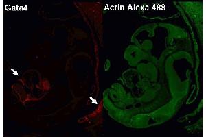 Following antigen retrieval with Retrievagen A (pH 6. (GATA4 antibody)