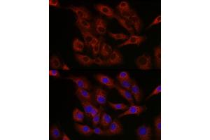 Immunofluorescence analysis of A-549 cells using Bcl-2 antibody (ABIN7265813) at dilution of 1:250. (Bcl-2 antibody  (AA 1-100))