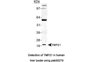 Image no. 2 for anti-Transmembrane Emp24-Like Trafficking Protein 10 (TMED10) (AA 100-200) antibody (ABIN363588) (TMED10 antibody  (AA 100-200))