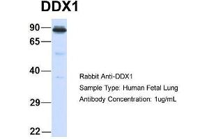 Host:  Rabbit  Target Name:  DDX1  Sample Type:  Human Fetal Lung  Antibody Dilution:  1. (DDX1 antibody  (Middle Region))