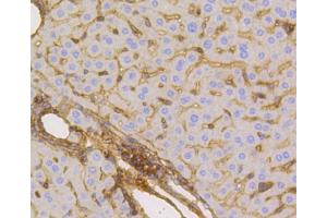 Immunohistochemistry of paraffin-embedded mouse liver using SLC2A1 antibody (ABIN5997113) at dilution of 1/100 (40x lens).