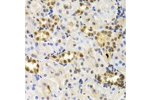 Immunohistochemistry of paraffin-embedded rat kidney using DNMT3A antibody at dilution of 1:200 (400x lens). (DNMT3A antibody)