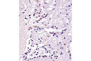 Immunohistochemistry (Paraffin-embedded Sections) (IHC (p)) image for anti-YY1 Transcription Factor (YY1) antibody (ABIN1882292)