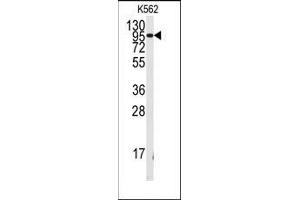 Western blot analysis of anti-FGFR1 Antibody in K562 cell line lysates (35ug/lane). (FGFR1 antibody  (Tyr154))