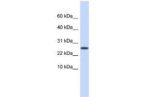 WB Suggested Anti-PDPN Antibody Titration: 0. (Podoplanin antibody  (Middle Region))