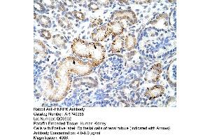 Rabbit Anti-HNRPK Antibody  Paraffin Embedded Tissue: Human Kidney Cellular Data: Epithelial cells of renal tubule Antibody Concentration: 4. (HNRNPK antibody  (N-Term))