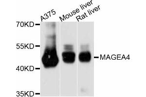 Western blot analysis of extracts of various cell lines, using MAGEA4 antibody. (MAGEA4 antibody)