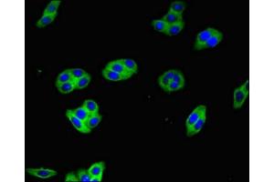 Immunofluorescent analysis of HepG2 cells using ABIN7154617 at dilution of 1:100 and Alexa Fluor 488-congugated AffiniPure Goat Anti-Rabbit IgG(H+L) (HRAS antibody  (AA 12-181))