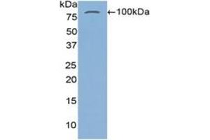 WB of Protein Standard: different control antibodies against Highly purified E. (Transglutaminase 2 ELISA Kit)