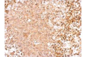 IHC-P Image GAD65 antibody [C2C3], C-term detects GAD2 protein at cytosol on RT2 xenograft by immunohistochemical analysis. (GAD65 antibody  (C-Term))