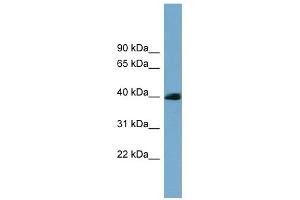 CXORF9 antibody used at 1 ug/ml to detect target protein. (SASH3 antibody  (N-Term))
