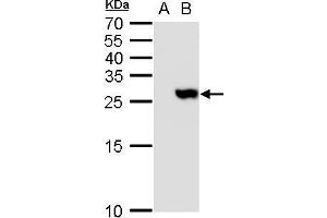 WB Image TMS1 antibody detects TMS1 protein by western blot analysis. (PYCARD antibody)