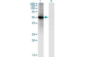 Western Blot analysis of RORB expression in transfected 293T cell line by RORB monoclonal antibody (M01), clone 4B4. (RORB antibody  (AA 136-224))