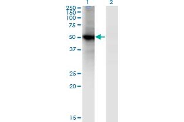 RORB anticorps  (AA 136-224)