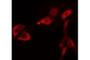 ABIN6275468 staining Hela cells by IF/ICC. (RAB38 antibody  (Internal Region))