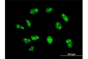 Immunofluorescence (IF) image for anti-Exosome Component 7 (EXOSC7) (AA 1-291) antibody (ABIN524917)