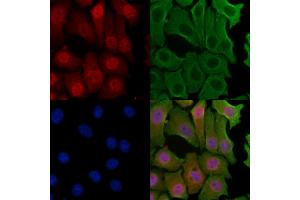 ABIN6257658 and ABIN6274323 staining Hela cells by IF/ICC.