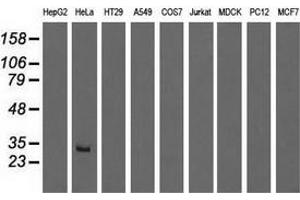 Western blot analysis of extracts (35 µg) from 9 different cell lines by using anti-GSTT2 monoclonal antibody. (GSTT2 antibody)