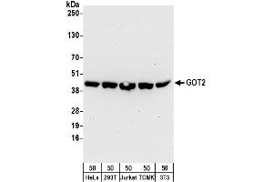 Western Blotting (WB) image for anti-Glutamic-Oxaloacetic Transaminase 2, Mitochondrial (Aspartate Aminotransferase 2) (GOT2) (AA 380-430) antibody (ABIN7454581)