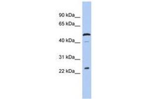 Image no. 1 for anti-Chromosome 1 Open Reading Frame 190 (C1orf190) (AA 143-192) antibody (ABIN6744005) (Chromosome 1 Open Reading Frame 190 (C1orf190) (AA 143-192) antibody)