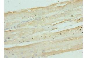 Immunohistochemistry of paraffin-embedded human skeletal muscle tissue using ABIN7165854 at dilution of 1:100 (NDRG2 antibody  (AA 152-371))