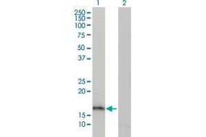 Western Blotting (WB) image for anti-Anterior Gradient Homolog 2 (Xenopus Laevis) (AGR2) (AA 1-175) antibody (ABIN564604)