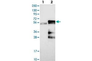 Western blot analysis of Lane 1: Negative control (vector only transfected HEK293T lysate), Lane 2: Over-expression Lysate (Co-expressed with a C-terminal myc-DDK tag (~3. (KCMF1 antibody)