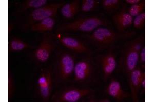Immunofluorescence staining of methanol-fixed Hela cells using Myc(Phospho-Thr358) Antibody. (c-MYC antibody  (pThr358))