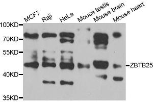 Western blot analysis of extracts of various cell lines, using ZBTB25 antibody (ABIN5975302) at 1/1000 dilution. (ZBTB25 antibody)