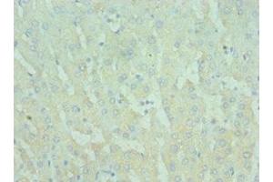 TIRAP antibody  (AA 1-221)