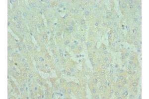 Immunohistochemistry of paraffin-embedded human liver tissue using ABIN7172290 at dilution of 1:100 (TIRAP antibody  (AA 1-221))