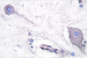 Image no. 2 for anti-Signal-Regulatory Protein alpha (SIRPA) antibody (ABIN271815)