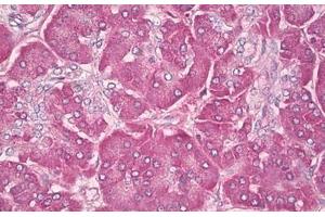 Image no. 2 for anti-GTPase NRas (NRAS) (AA 91-140) antibody (ABIN6749779) (GTPase NRas antibody  (AA 91-140))