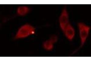 ABIN6278554 staining 293 cells by IF/ICC. (AWAT1 antibody  (Internal Region))