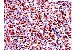Immunohistochemistry of paraffin-embedded human pancreatic tissue using ABIN7154138 at dilution of 1:100 (GAPDH antibody  (AA 3-335))