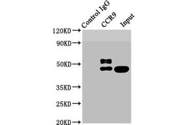 Recombinant CCR9 antibody