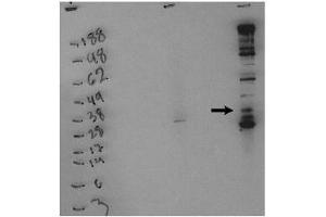 Image no. 1 for anti-Sphingosine Kinase 1 (SPHK1) (pSer225) antibody (ABIN4620349)