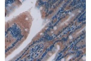 Used in DAB staining on fromalin fixed paraffin- embedded liver tissue (CXCL7 antibody  (AA 46-107))