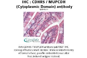 Image no. 1 for anti-Mucin and Cadherin-Like (CDHR5) (Cytoplasmic Domain) antibody (ABIN1732921) (CDHR5 antibody  (Cytoplasmic Domain))