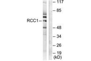 Western blot analysis of extracts from LOVO cells, using RCBTB1 Antibody. (RCBTB1 antibody  (AA 251-300))