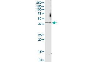 Immunoprecipitation of CDK6 transfected lysate using anti-CDK6 MaxPab rabbit polyclonal antibody and Protein A Magnetic Bead , and immunoblotted with CDK6 MaxPab mouse polyclonal antibody (B01) . (CDK6 antibody  (AA 1-326))