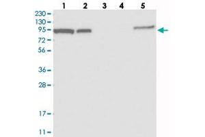 Western blot analysis of Lane 1: RT-4, Lane 2: U-251 MG, Lane 3: Human Plasma, Lane 4: Liver, Lane 5: Tonsil with KPNB1 polyclonal antibody  at 1:250-1:500 dilution. (KPNB1 antibody)