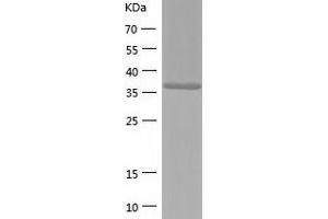Western Blotting (WB) image for Tropomodulin 3 (TMOD3) (AA 1-352) protein (His tag) (ABIN7289123) (TMOD3 Protein (AA 1-352) (His tag))