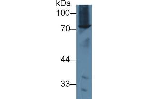 Detection of ABCD2 in Mouse Spleen lysate using Polyclonal Antibody to ATP Binding Cassette Transporter D2 (ABCD2) (Abcd2 antibody  (AA 501-695))