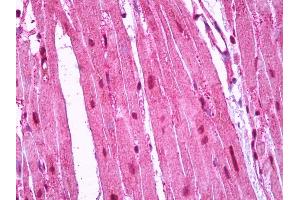 Anti-RRAS antibody IHC of human heart. (R-Ras antibody)