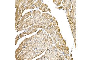 Immunohistochemistry (IHC) image for anti-Complement Component 1, Q Subcomponent Binding Protein (C1QBP) antibody (ABIN7266473)