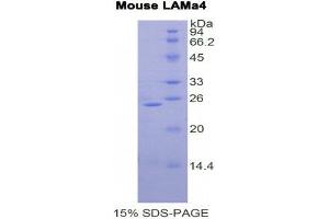 SDS-PAGE (SDS) image for Laminin, alpha 4 (LAMa4) (AA 745-940) protein (His tag) (ABIN2121519) (LAMa4 Protein (AA 745-940) (His tag))