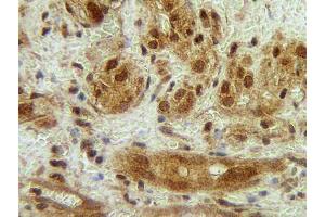 Image no. 3 for anti-Colony Stimulating Factor 3 (Granulocyte) (CSF3) antibody (ABIN465577) (G-CSF antibody)