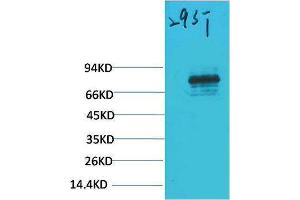 Western Blotting (WB) image for anti-Signal Transducer and Activator of Transcription 3 (Acute-Phase Response Factor) (STAT3) antibody (ABIN3188049) (STAT3 antibody)