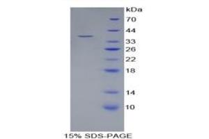 SDS-PAGE of Protein Standard from the Kit  (Highly purified E. (LRG1 ELISA Kit)